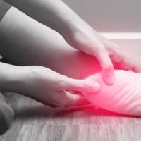 Plantar fasciitis